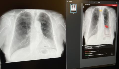 Umělá inteligence (AI) přináší revoluční změny do medicíny. V posledních letech se stává klíčovým faktorem v diagnostice a léčbě nemocí. Jedním z příkladů, jak AI mění zdravotnickou praxi, je systém Carebot, který používají na radiologickém oddělení v Nemocnici Tábor, a.s.